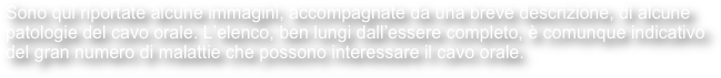 Sono qui riportate alcune immagini, accompagnate da una breve descrizione, di alcune patologie del cavo orale. L’elenco, ben lungi dall’essere completo, è comunque indicativo del gran numero di malattie che possono interessare il cavo orale.
