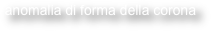 anomalia di forma della corona