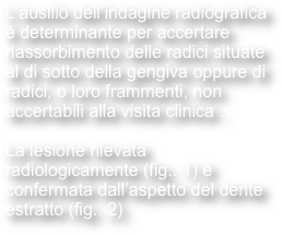 L’ausilio dell’indagine radiografica è determinante per accertare riassorbimento delle radici situate al di sotto della gengiva oppure di radici, o loro frammenti, non accertabili alla visita clinica .

La lesione rilevata radiologicamente (fig.. 1) è confermata dall’aspetto del dente estratto (fig.. 2)