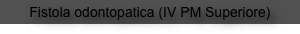 Fistola odontopatica (IV PM Superiore)