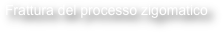 Frattura del processo zigomatico